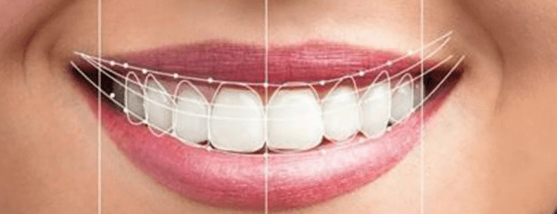 Aesthetic Smile Design