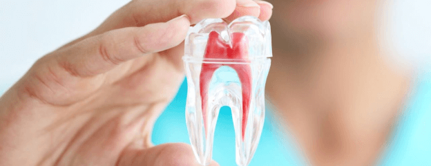 Root Canal Treatment (Endodontics)